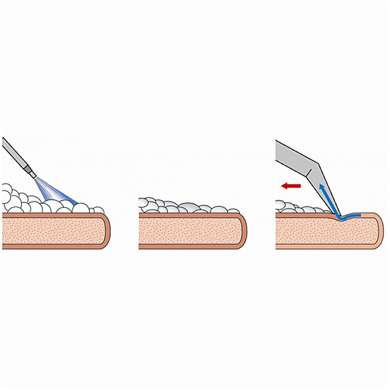 5ce5e92376bc4e8094fd2059d3aa97cd